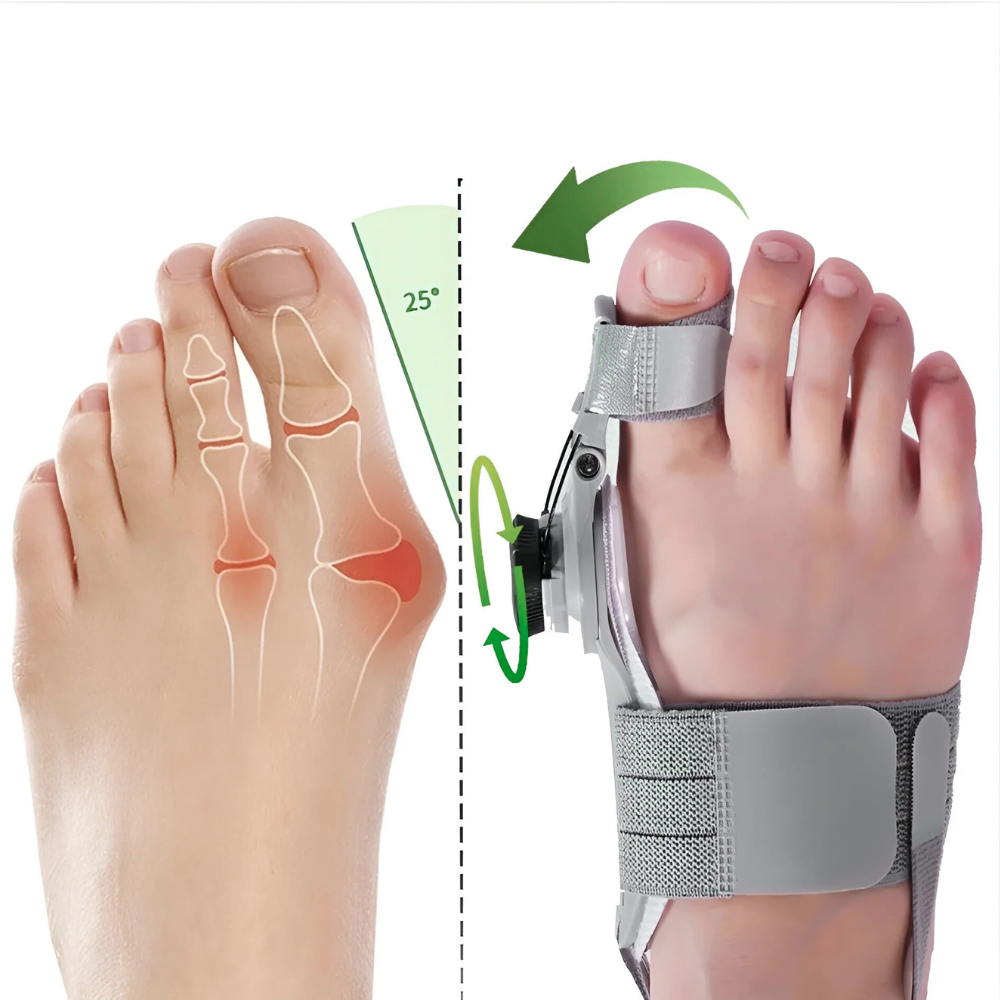 Wisemed™ Bunion Fix